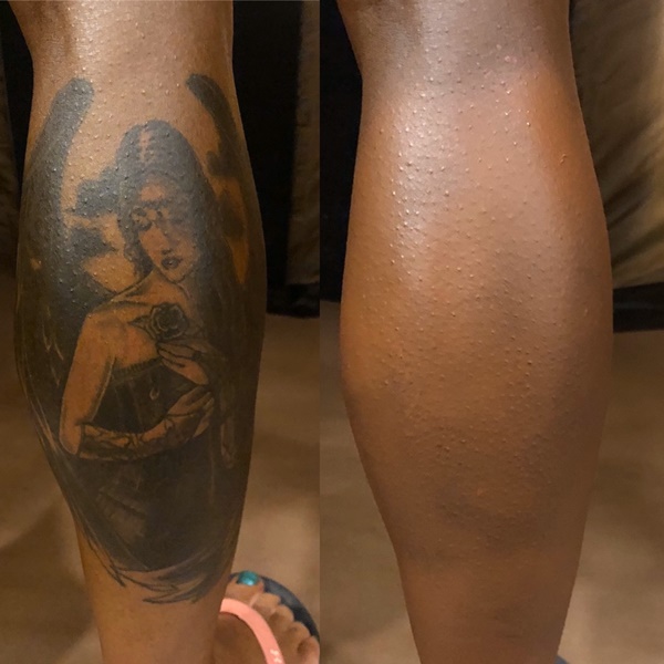 Tattoo Cover Up Service - Image 2